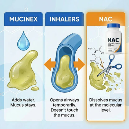 NAC N-Acetyl-L-Cysteine for Daily Antioxidant Support (30 Capsules)