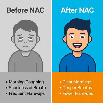 NAC N-Acetyl-L-Cysteine for Daily Antioxidant Support (30 Capsules)